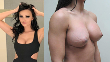 Brittney Atwood Nude Boob Job Fotos Fleated