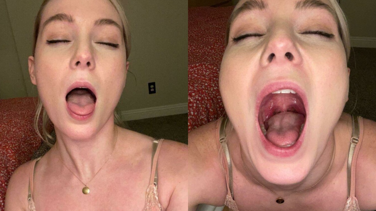 Estope de la boca abierta Conjunto de solicitudes personalizadas